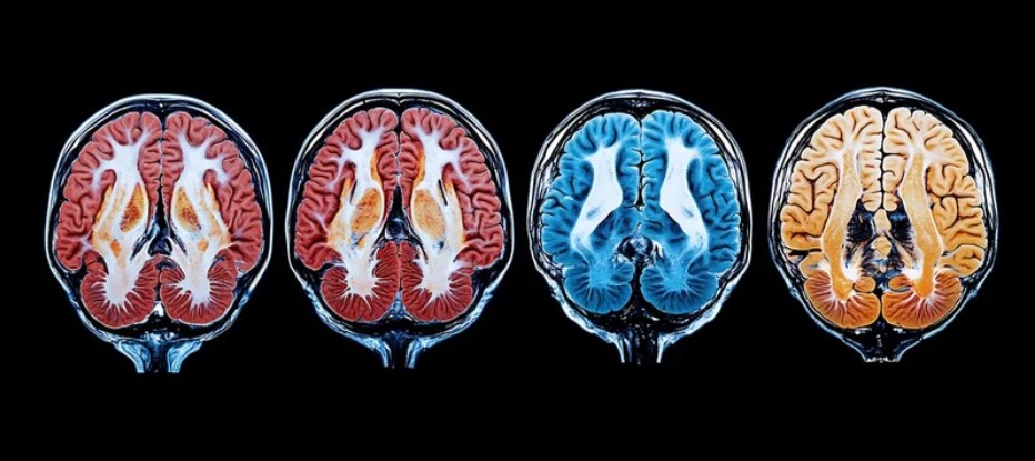 Sports Injury Concussion Neurological Impacts DRX Chicago .webp