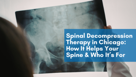Spinal Decompression Treatment Therapy @ DRX Chicago